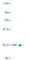 SDS-PAGE - Recombinant Human Thymosin beta 10 protein (GST tag N-Terminus) (AB132133)