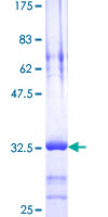 SDS-PAGE - Recombinant Human Thymosin beta 4 protein (AB112365), expandable thumbnail