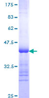 SDS-PAGE - Recombinant Human Thyroglobulin protein (GST tag N-Terminus) (AB152743)