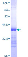 SDS-PAGE - Recombinant Human Thyroglobulin protein (GST tag N-Terminus) (AB152743)