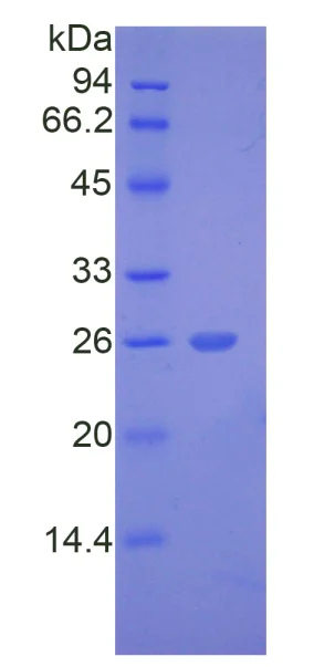 SDS-PAGE - Recombinant Human Thyroid Peroxidase/TPO protein (His tag) (AB275556)