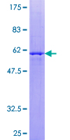 SDS-PAGE - Recombinant Human Thyrotropin Releasing Hormone (TRH) protein (AB159747), expandable thumbnail