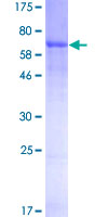 Recombinant Human Thyroxine Binding Globulin protein