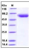 SDS-PAGE - Recombinant Human Thyroxine Binding Globulin protein (His tag) (AB276347)