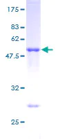 SDS-PAGE - Recombinant Human TIA1 protein (AB131879)