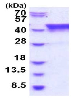 SDS-PAGE - Recombinant Human TIAL1 protein (His tag N-Terminus) (AB187470)
