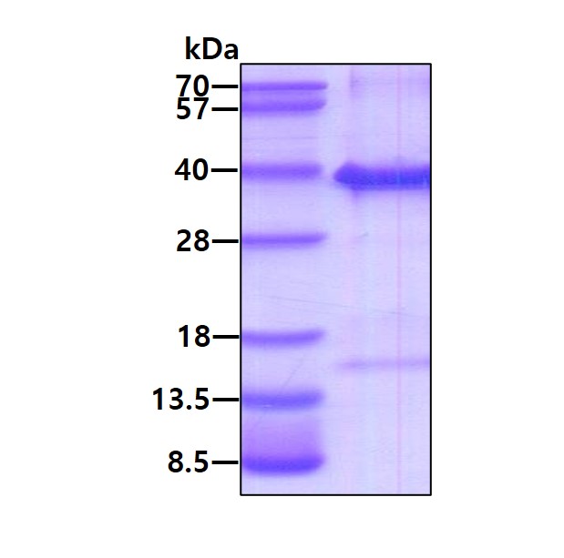 SDS-PAGE - Recombinant Human TICAM2 protein (His tag N-Terminus) (AB123160)