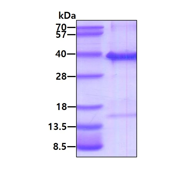 SDS-PAGE - Recombinant Human TICAM2 protein (His tag N-Terminus) (AB123160)
