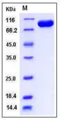 SDS-PAGE - Recombinant Human TIE1 protein (His tag) (AB276284)