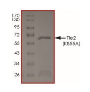 Recombinant Human TIE2 (mutated K855A) protein (Tagged)