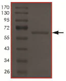 SDS-PAGE - Recombinant human TIE2 (mutated R849W) protein (Active) (AB186089)