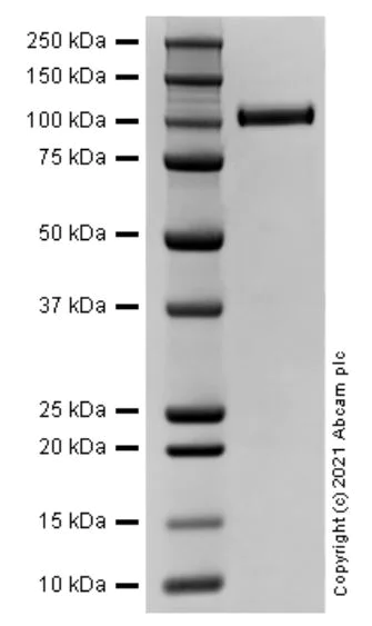 SDS-PAGE - Recombinant Human TIE2 protein (AB283468)