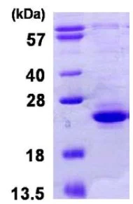 SDS-PAGE - Recombinant Human TIFA protein (His tag N-Terminus) (AB123199)