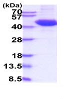 SDS-PAGE - Recombinant Human TIGIT protein (Tagged) (AB227414), expandable thumbnail