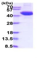SDS-PAGE - Recombinant Human TIGIT protein (Tagged) (AB227414)
