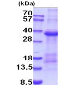 SDS-PAGE - Recombinant Human TIM 1 protein (denatured) (AB203537)