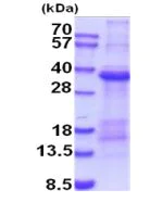 SDS-PAGE - Recombinant Human TIM 1 protein (denatured) (AB203537)