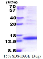 SDS-PAGE - Recombinant Human TIMM8A/DDP protein (His tag N-Terminus) (AB174417)
