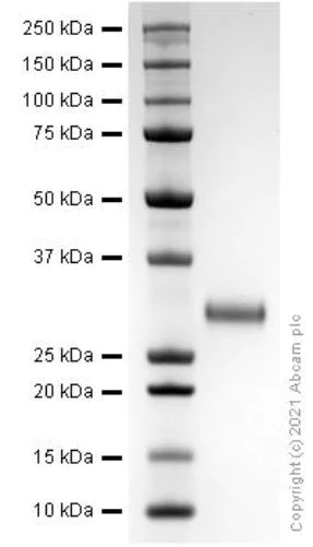 SDS-PAGE - Recombinant human TIMP1 protein (Active) (AB280945)