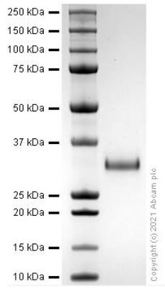 SDS-PAGE - Recombinant Human TIMP1 protein (His tag) (Active) (AB280386), expandable thumbnail
