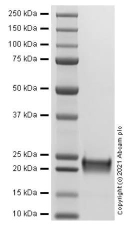 SDS-PAGE - Recombinant Human TIMP2 protein (AB287940)