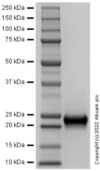 SDS-PAGE - Recombinant Human TIMP2 Protein (Active) (AB291057)