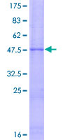 SDS-PAGE - Recombinant Human TIMP3 protein (AB159704), expandable thumbnail