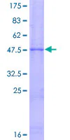 SDS-PAGE - Recombinant Human TIMP3 protein (GST tag N-Terminus) (AB159704)