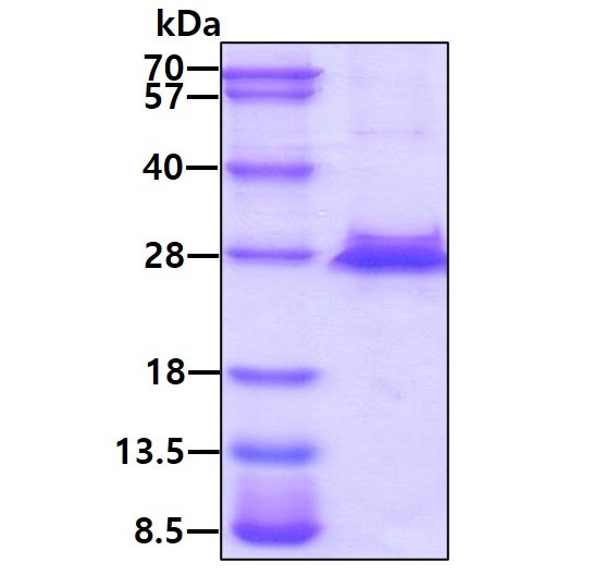 SDS-PAGE - Recombinant Human TIMP4 protein (His tag) (AB219421), expandable thumbnail
