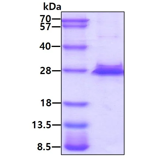 SDS-PAGE - Recombinant Human TIMP4 protein (His tag) (AB219421)