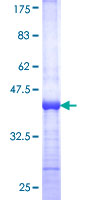 Recombinant Human Tin2 protein