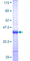 SDS-PAGE - Recombinant Human Tin2 protein (GST tag N-Terminus) (AB153274)