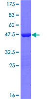 SDS-PAGE - Recombinant Human TIPE2 protein (AB164054)