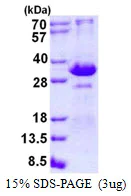 SDS-PAGE - Recombinant Human TIRAP protein (His tag N-Terminus) (AB131663)