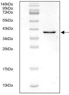 SDS-PAGE - Recombinant Human Tissue Factor protein (AB119148), expandable thumbnail