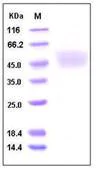 SDS-PAGE - Recombinant Human Tissue kallikrein protein (His tag) (AB276265)