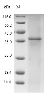 SDS-PAGE - Recombinant Human Titin protein (Tagged) (AB237002)