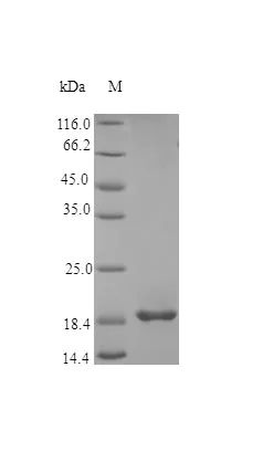 SDS-PAGE - Recombinant human TL1A protein (Active) (AB243769)