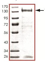 SDS-PAGE - Recombinant human TLK1 protein (AB125563)