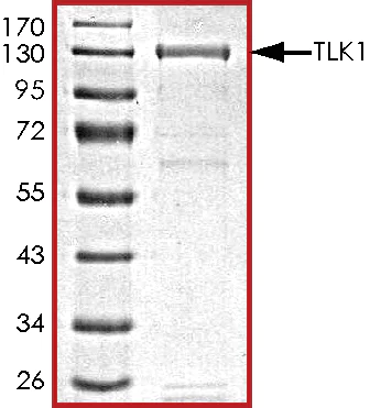 SDS-PAGE - Recombinant human TLK1 protein (AB125563)