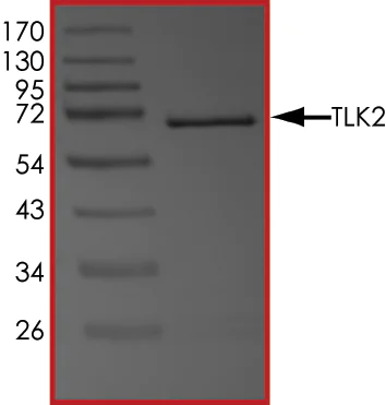 SDS-PAGE - Recombinant human TLK2 protein (AB89855)