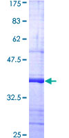 SDS-PAGE - Recombinant Human TLR2 protein (AB159715)