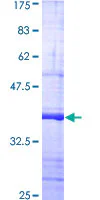 SDS-PAGE - Recombinant Human TLR2 protein (GST tag N-Terminus) (AB159715)
