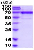 SDS-PAGE - Recombinant Human TLR2 protein (His tag) (AB222352), expandable thumbnail