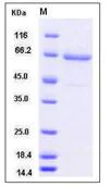 SDS-PAGE - Recombinant Human TLR2 protein (His tag) (AB276197)