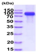 SDS-PAGE - Recombinant Human TLR3 protein (His tag) (AB233604)