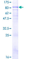 SDS-PAGE - Recombinant Human TLR4 protein (AB159717), expandable thumbnail