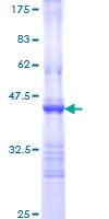 Recombinant Human TLR5 protein