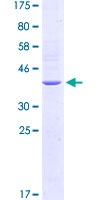 SDS-PAGE - Recombinant Human TLR5 protein (GST tag N-Terminus) (AB152752)