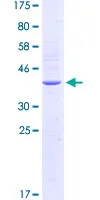 SDS-PAGE - Recombinant Human TLR5 protein (AB152752)